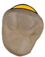 NAKACHO DENTAL OFFICE(中長デンタルオフィス|南森町から徒歩4分にある歯科)マイクロエンド