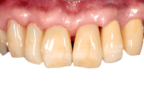 NAKACHO DENTAL OFFICE(中長デンタルオフィス|南森町から徒歩4分にある歯科)症例